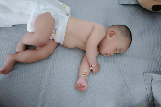 漳浦宝宝脸上有白色斑块